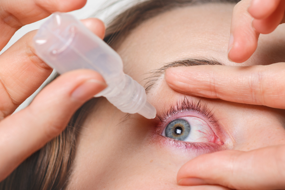 Dry Eye